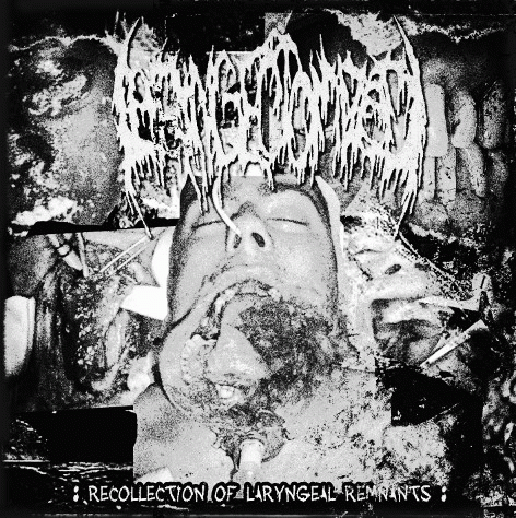 Laryngectomized : Recollection of Laryngeal Remnants